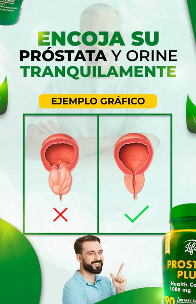 PROSTE PLUSS